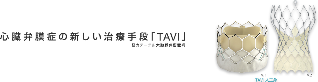 心脏瓣膜病最新治疗方法“TAVI”