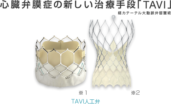 心臓弁膜症の新しい治療手段「TAVI」