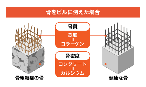 骨をビルに例えた場合 骨粗鬆症の骨 骨質 鉄筋＝コラーゲン 骨密度 コンクリート＝カルシウム 健康な骨