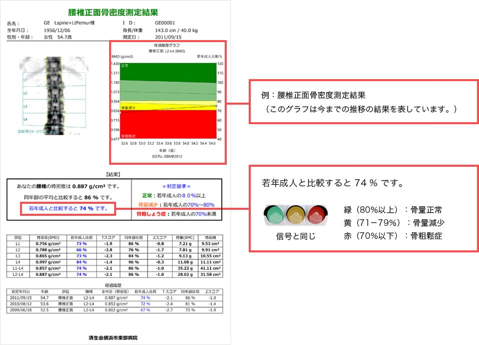 当院でお渡ししている検査結果レポート