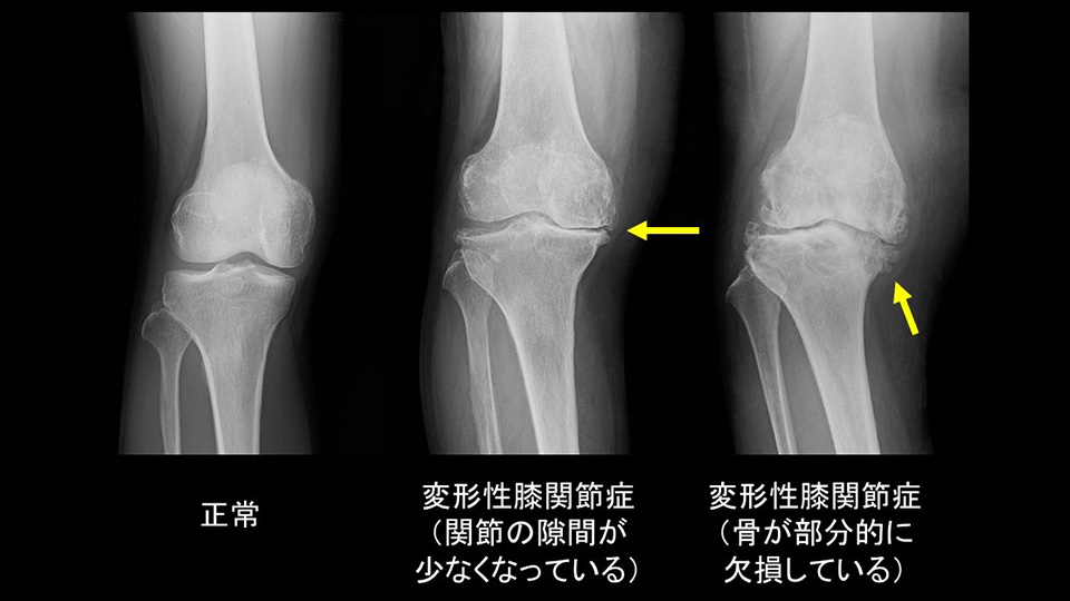 治療方法は？