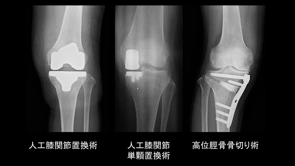 外科的治療（手術）にはどんな方法がありますか？