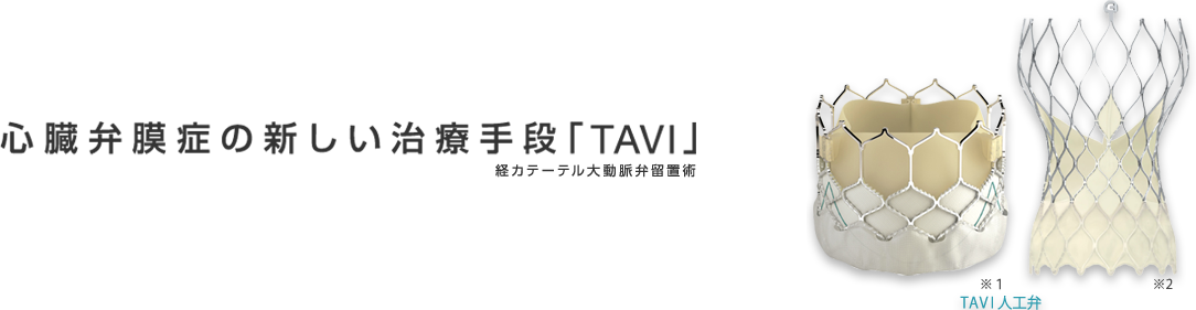 心臓弁膜症の新しい治療手段「TAVI」