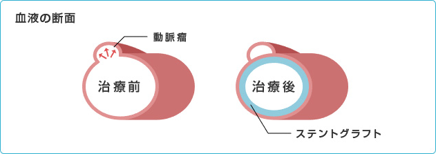 Blood cross section