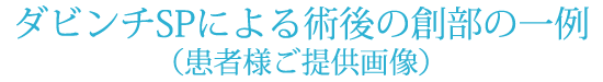 ダビンチSPによる術後の創部の一例