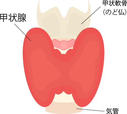 Thyroid tumor (nodule)