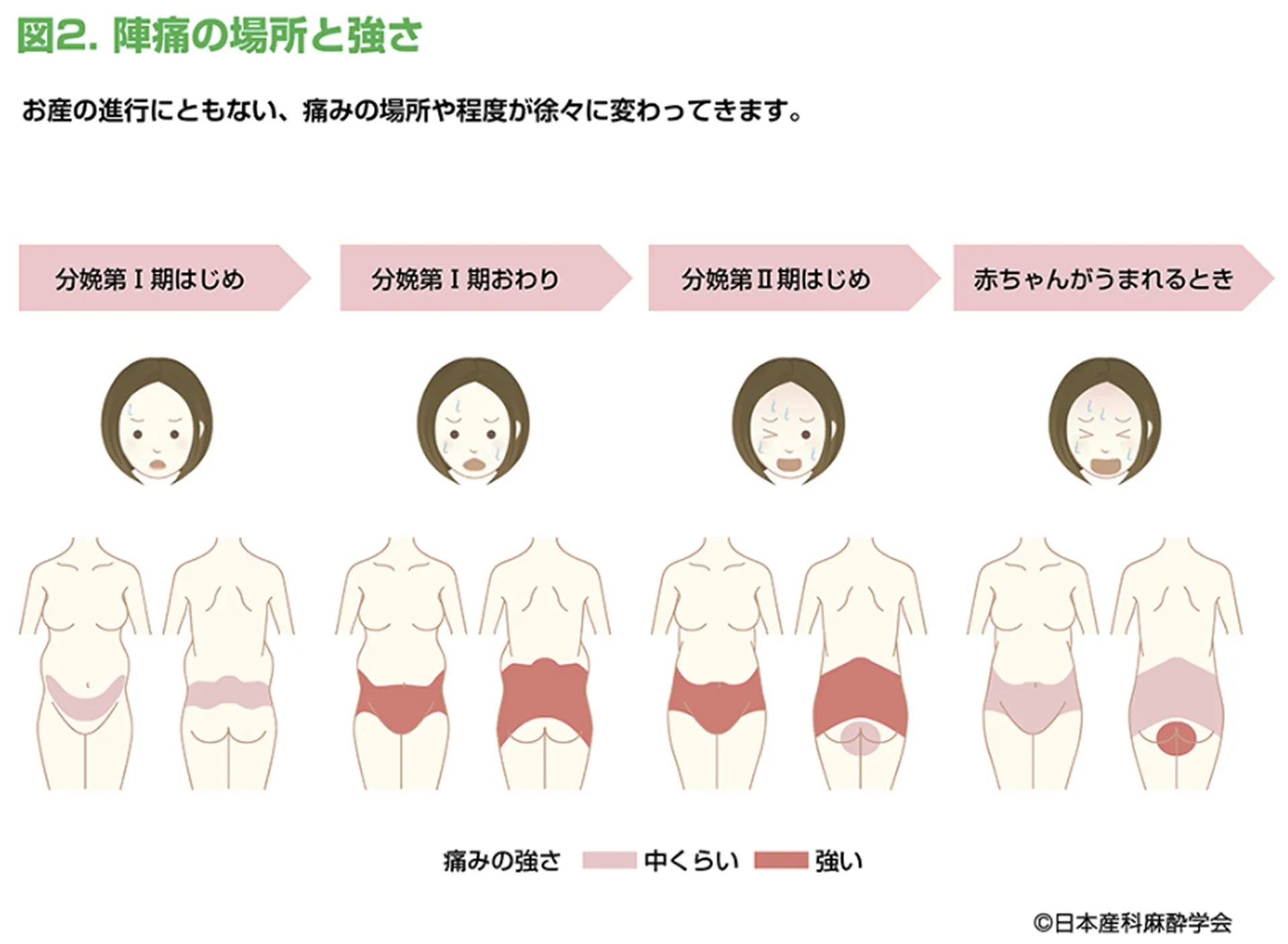 図2 陣痛の場所と痛さ