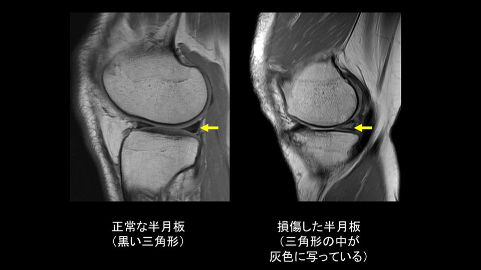 どのように診断するのでしょうか？