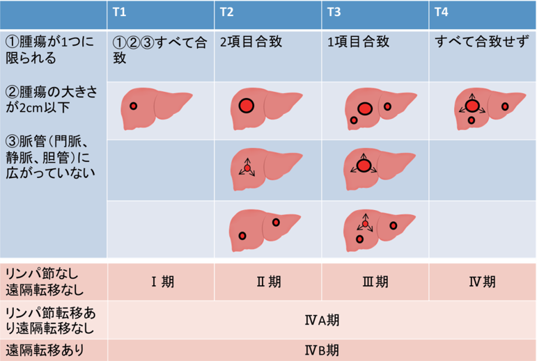 肝臓癌